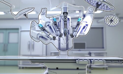 Robotske operacije, transplatacija