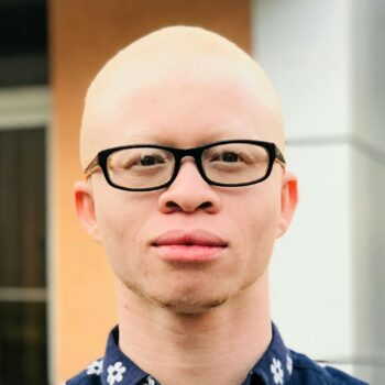 Albino crnac