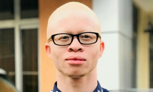 Albino crnac