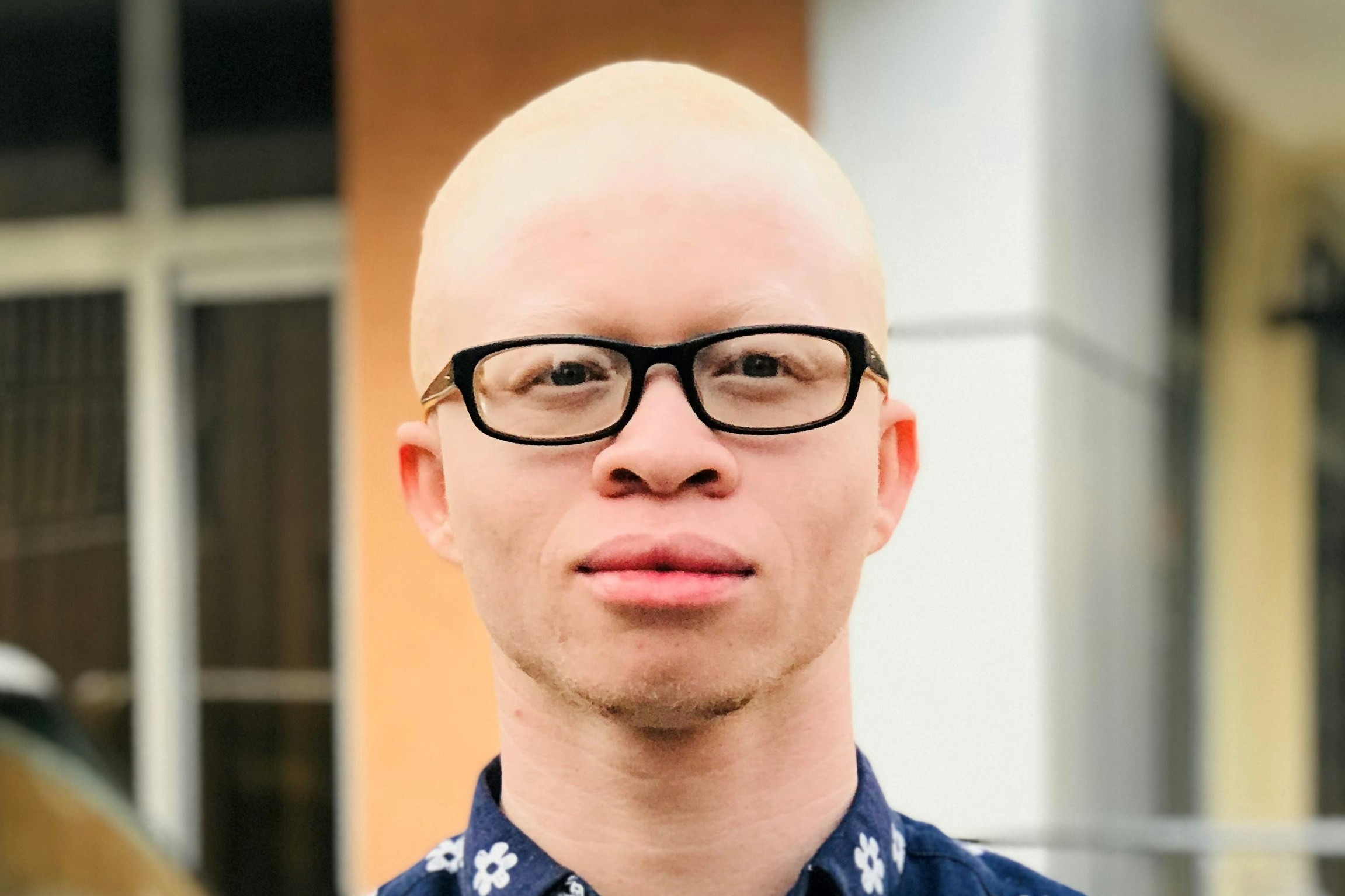 Albino crnac